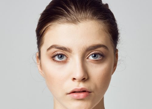 Photo of a woman experiencing a loss of facial volume