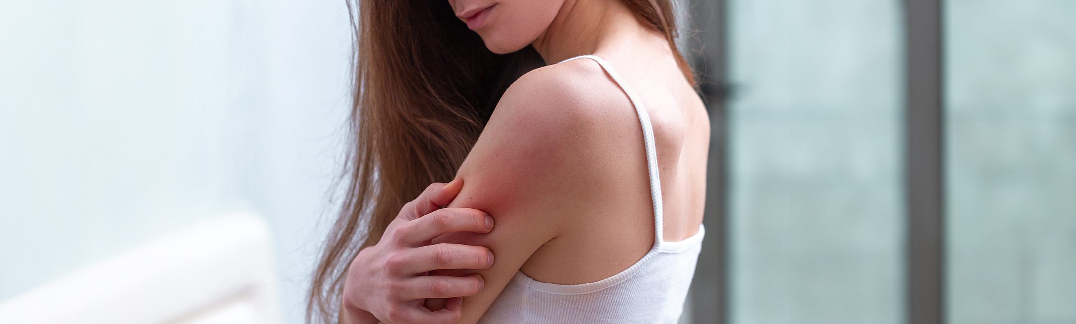 Psoriasis