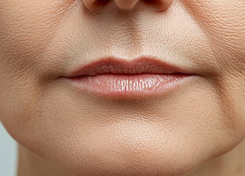 Photo of a woman's lower face and lips