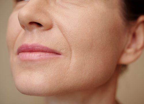 Photo of a woman's lower face with signs of skin laxity