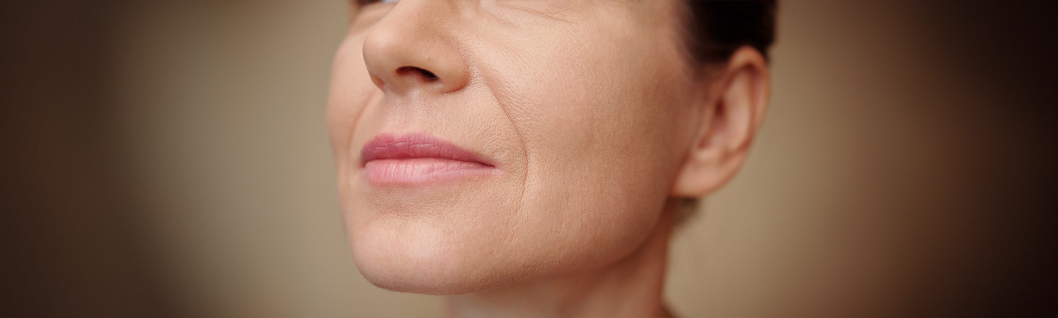 Skin Laxity