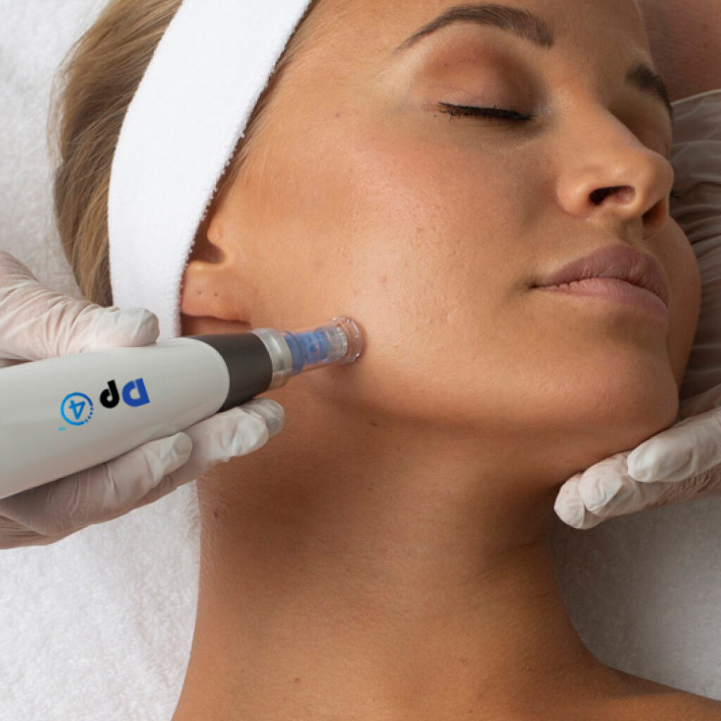 Nurse Ashley using the DP4 Microneedle for skin tightening in Queen Creek.